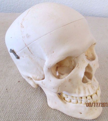 SOMSO Model Of The Artificial Human Skull - Used by a Dentist