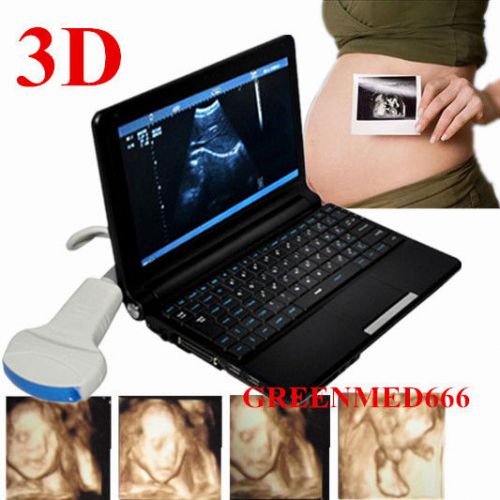 CE FDA Full Digital Diagnostic System Ultrasound Scanner +3.5 MHZConvex Probe