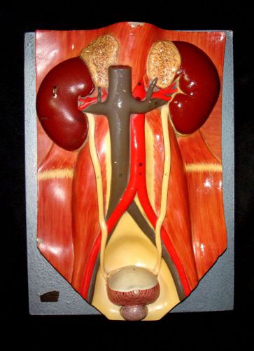 Antique / Vintage SOMSO LS3 Plaster Urinary System Kidney Anatomical Model