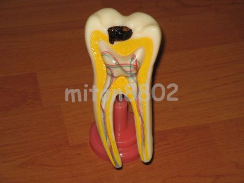 NEW MODEL GIANT MOLAR A CROSS SECTION TOOTH DENTISTRY TEETH STUDY
