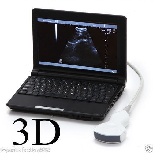 10.1 Inch Digital Laptop B Ultrasound Scanner/Machine + Convex Probe + Free 3D