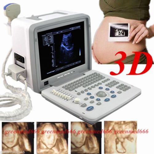 2015 New 3D+Full Digital Portable Ultrasound Scanner +Convex Probe ClearImage