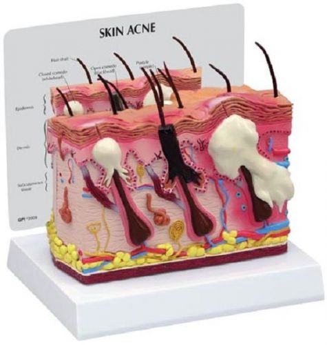 NEW Anatomical Skin Normal Acne Two-Sided Model
