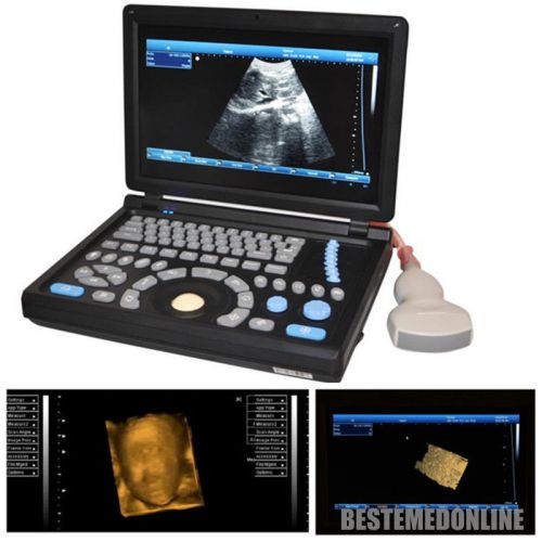 10.4 inch build-in 3d full digital laptop ultrasound scanner (pc) +convex probe for sale