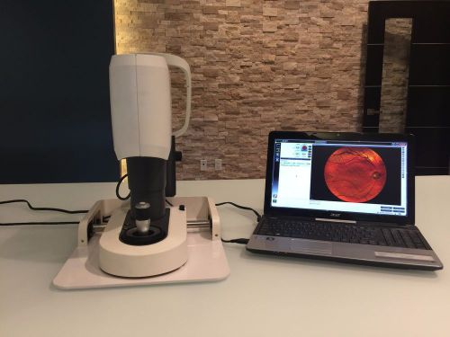 I-OPTICS Ioptics EasyScan Retinal Imagining SLO Digital Fundus Camera w Laptop