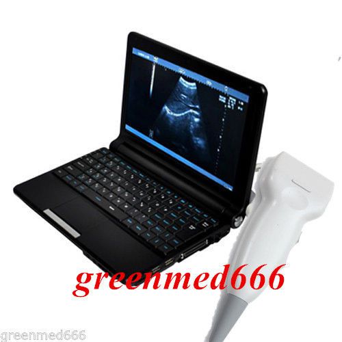 10.1&#034; Digital Laptop Ultrasound Scanner For Human with Linear probe+3D Station