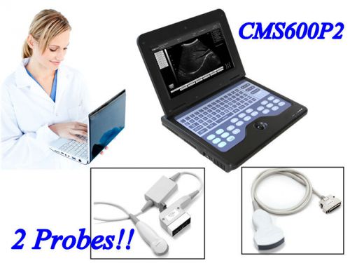 Portable Digital Ultrasound scanner Diagnostic system+ Convex+ Cardiac 2 probes