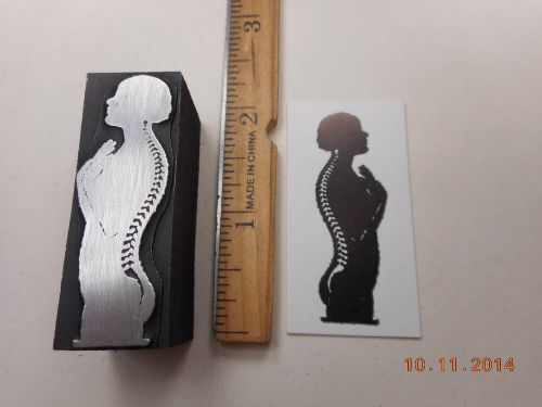 Letterpress Printing Printers Block, Chiropractic Spine Medical Illustration