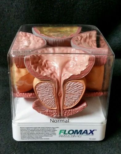 Flomax Anatomical Model Human Prostate Model FL12201 Pathology