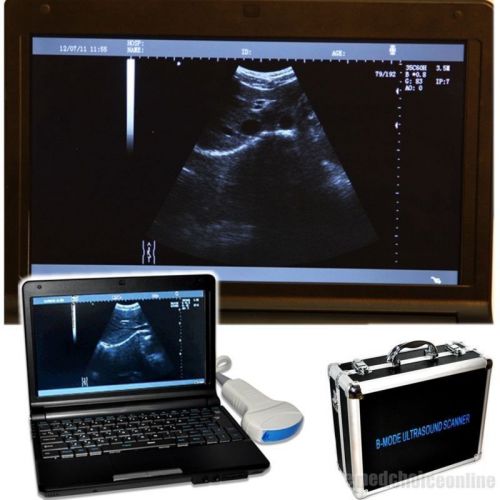 Digital Laptop Ultrasound Scanner Portable BOX Convex Probe+2014NEW FREE 3D VGA