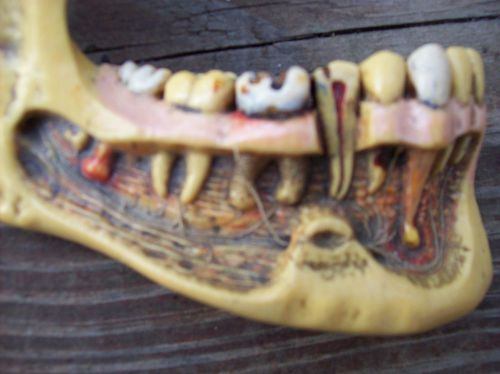 dental teeth and gum model