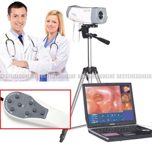 Portable digital electronic colposcope sony 800,000 pixels newest version+tripod for sale