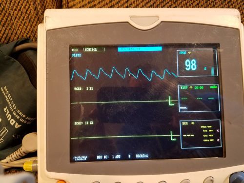 Patient Monitor, NIBP/SPO2/ECG/ Cardiac Monitor 5 lead