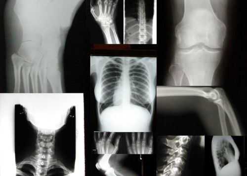 Lot 17 real human x rays xray bone freaky haunting art weird unusual twisted for sale