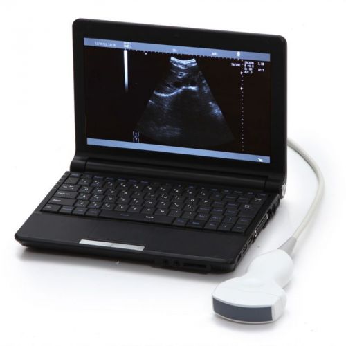 Factory10.1 inch Full Digital Laptop Ultrasound Scanner+Convex Probe External 3D