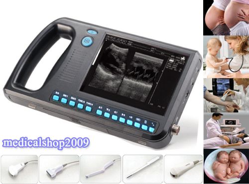 PalmSmart NOTEBOOK Ultrasound Scanner Diagnostic system + 3.5convex probe
