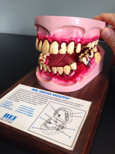 vintage MR GROSS MOUTH Model TEETH Tongue Anatomy MEDICAL Dental Health Edco 70s