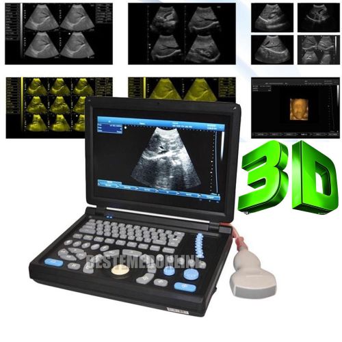 Built-in 3d laptop ultrasound scanner digital ultrasound machine pc + 3.5 convex for sale