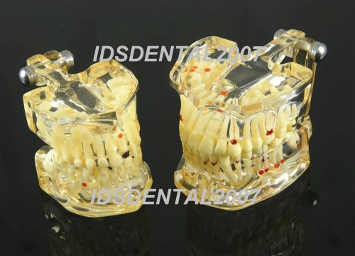 Dental Demonstration Pathologies Teeth Model 1 Adult 1 Child NEW