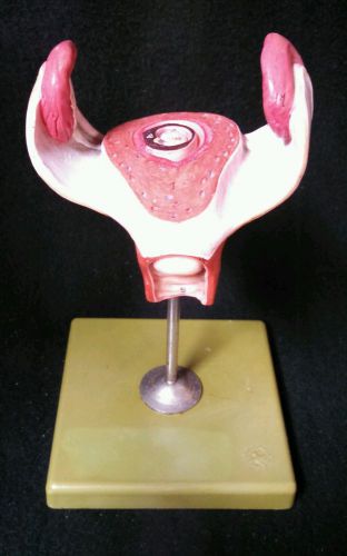 SOMSO - MS12/1 Uterus, Fetus, Embryo in 1st Month of Pregnancy Anatomical Model