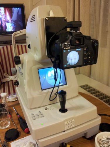 TOPCON TRC-NW6 DIGITAL CONVERTED NM RETINAL CAMERA