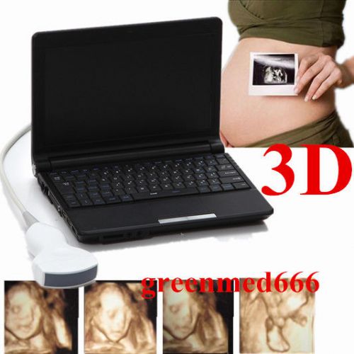Laptop Ultrasound Scanner Digital Mobile Diagnostic System +Convex Probe+3D*FDA