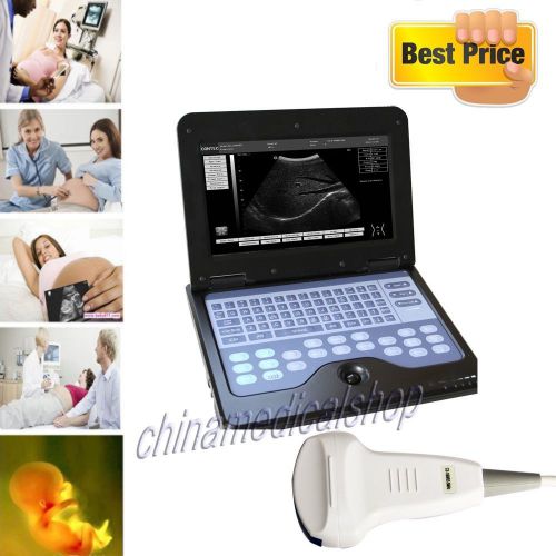 Promotion digital laptop ultrasound scanner machine 3.5 convex probe 2y warranty for sale