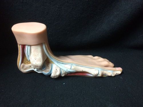 SOMSO NS2 - Flat Foot (Pes Panus) Anatomical Teaching Model (NS 2)