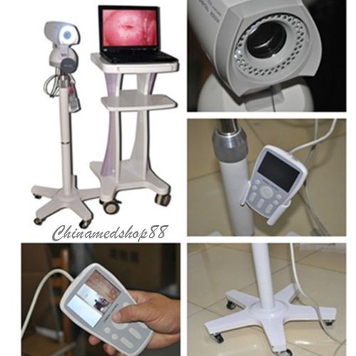 2015 new software digital video 850,000 pixels electronic colposcope sony camera for sale