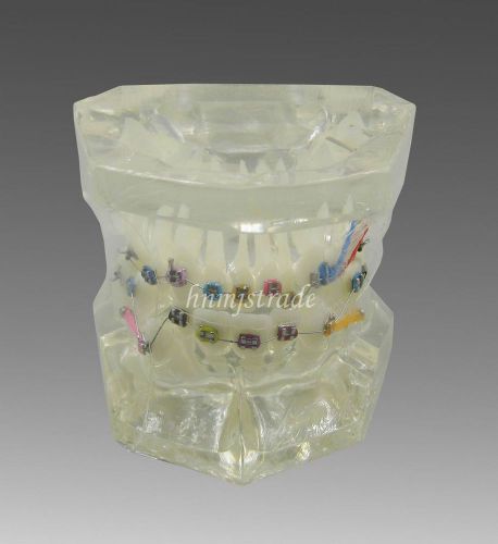 Dental Orthodontic Treatment Model With Bracket and Arch Wire G221 hnm