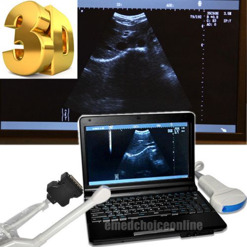 NEW Full Digital Laptop Ultrasound Scanner Machine + Convex + Trans-vaginal + 3D