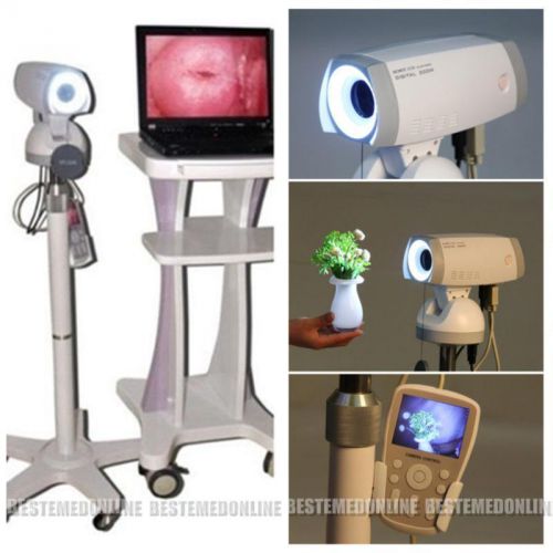 Digital video electronic colposcope sony camera850,000 pixels gynaecology tripod for sale