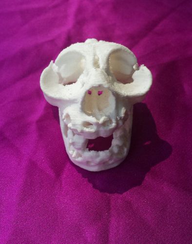 Human Fetal Baby Infant RARE ANENCEPHALIC SKULL reproduction anatomical model