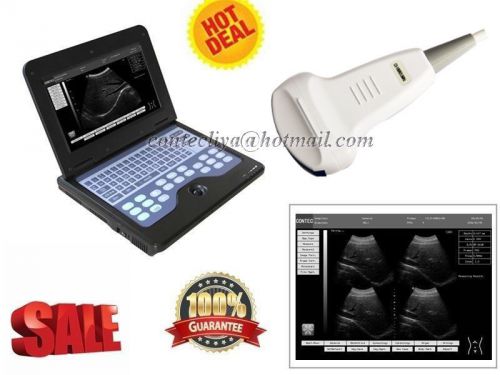 Hot Deal Laptop Ultrasound Diagnostic Scanner machine+3.5MHz Convex Probe,2y War
