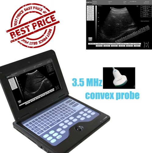 CONTEC Digital Smart laptop B-Ultrasound Scanner Diagnostic System +3.5mhz probe