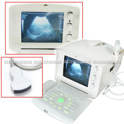 Digital Portable Ultrasound Scanner + 3.5MHz CONVEX probe + free 3D software BES
