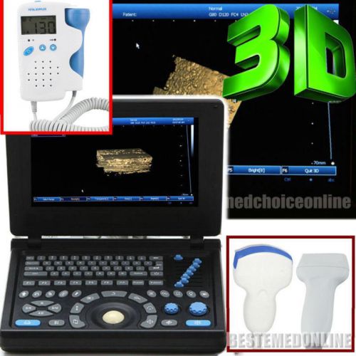 3D PC Platform Digital Handheld  Ultrasound Scanner+Convex+Linear + Doppler Sale