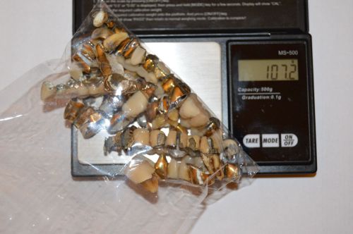 Dental Scrap 105  grams Sterilized