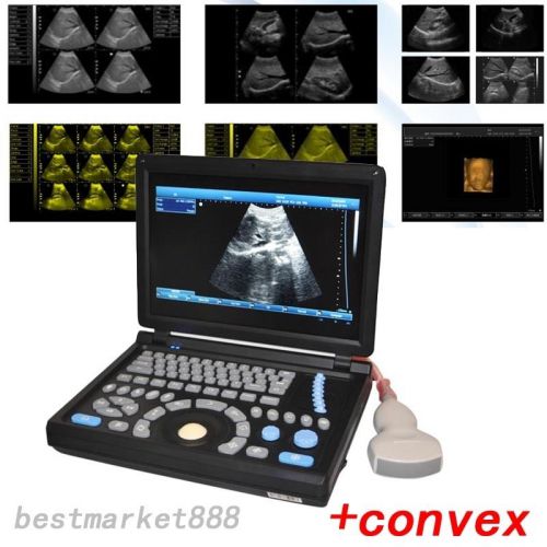 New 3d full digital laptop ultrasound scanner (pc)with convex probe lcd mornitor for sale