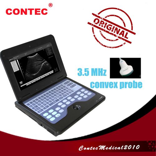 CMS600P2 Digital Smart laptop B-Ultrasound Scanner + 3.5MHZ convex probe