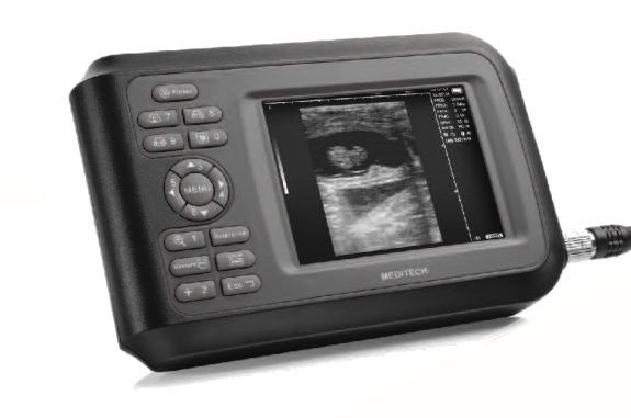 Handheld Ultrasound Scanner for Family Doctors, Clinic and Hospital