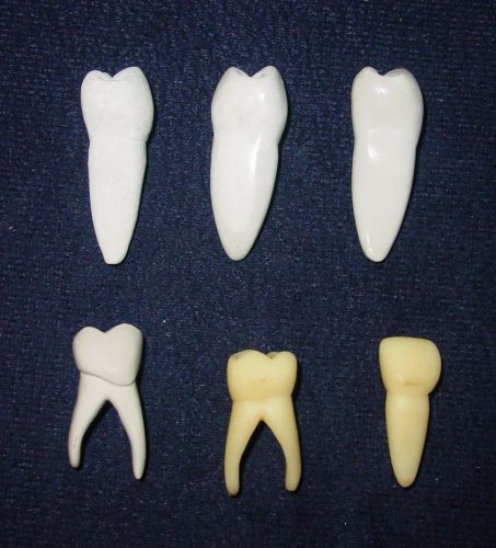 6 Large Ceramic Display Teeth For Dental Research Or Studies