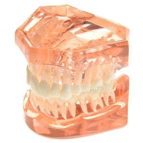 Dental JAW ADULT TYPODONT Model all teeth Removable transparent Upper and lower