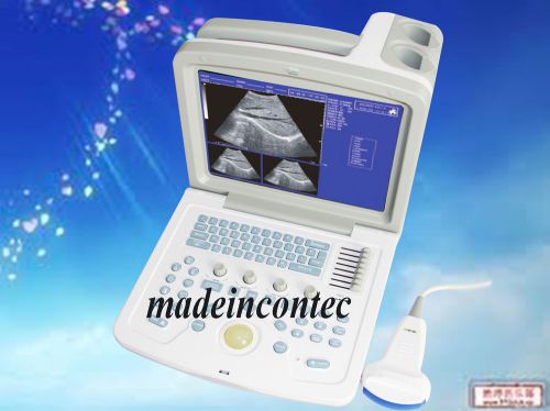 On Sale!!2014 CE portable Ultrasound Scanner CMS600B-3 With 3.5MHZ Convex Probe