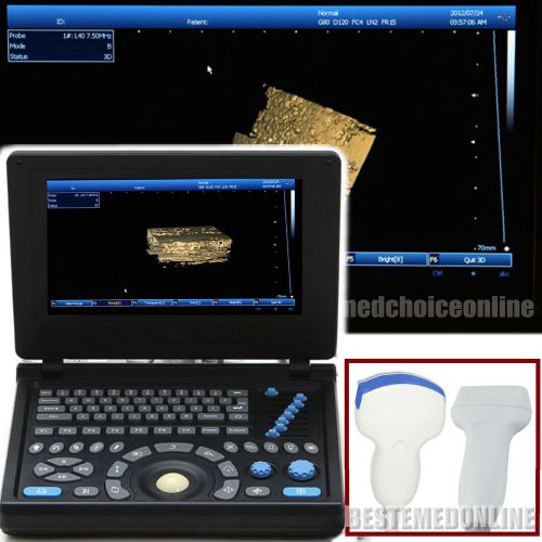 3.5 convex + 7.5 linear pc based platform laptop full digital ultrasound scanner for sale