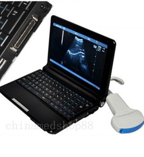 2015 New Digital Laptop/portable Ultrasound Scanner/Machine +Convex probe+3D USB