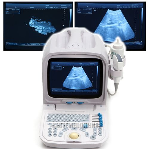 NEW 3D PC platform Ultrasound Scanner w 3.5MHz CONVEX probe print via laser