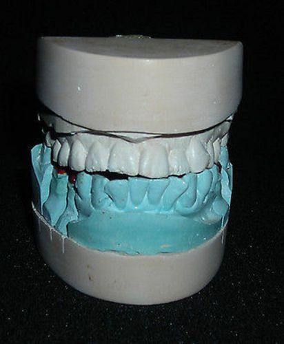Vintage Dental Impressions Clay Dental Denture Oddity Display