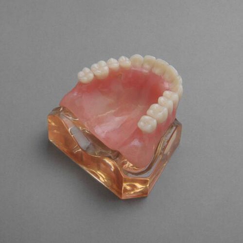 Dental Model #6001 01 - Overdenture Superior with 4 Implants Demo Model