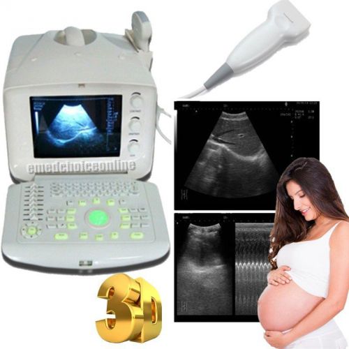 New portable ultrasound scanner machine with free external 3d software &amp;linear for sale